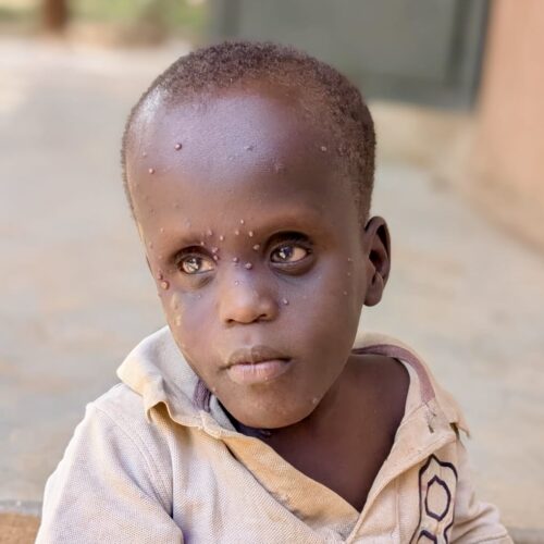 Opio Muya Benjamin (Sponsored)